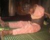 Căn bệnh lạ khiến bé gái 9 năm phải mang thân hình 'người thú'